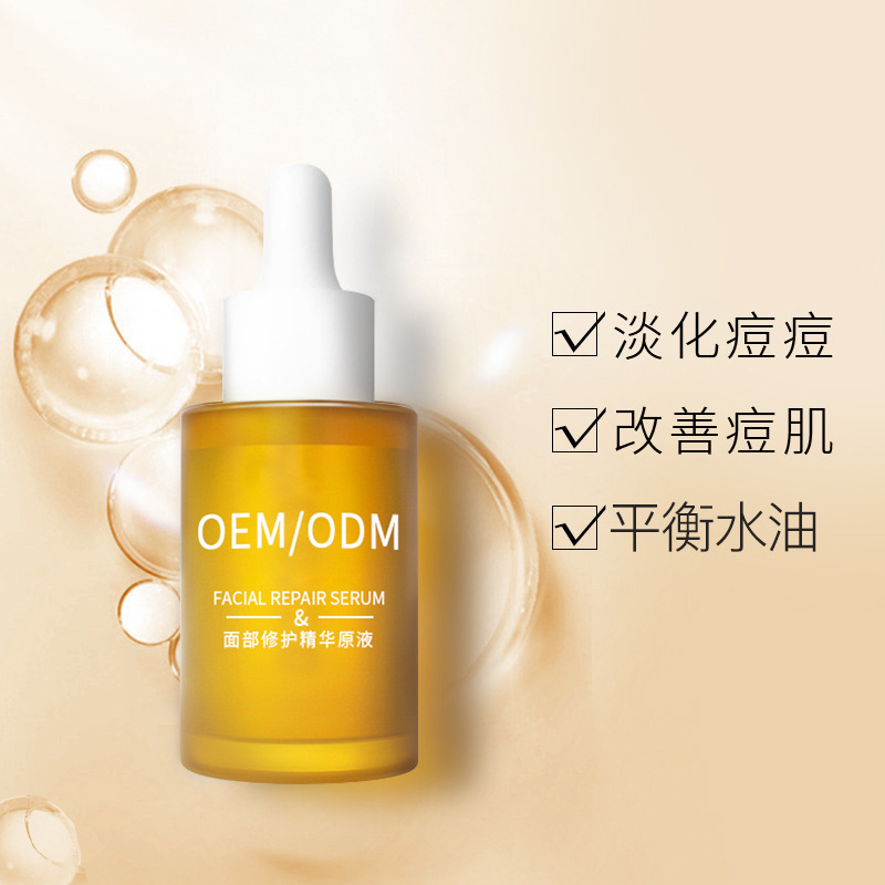 黄山市_祛痘精华原液OEM